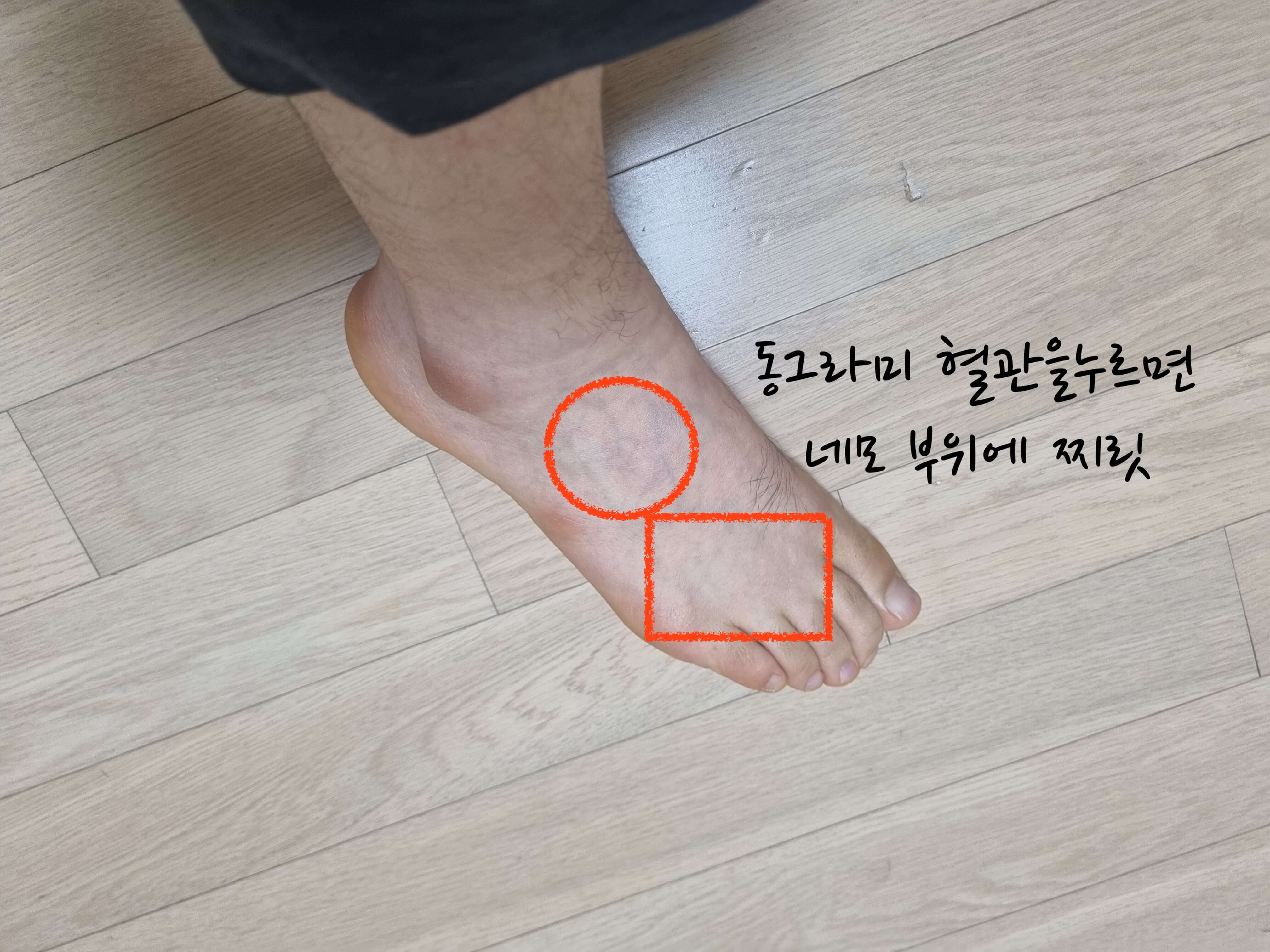 혈관 누르면 찌릿