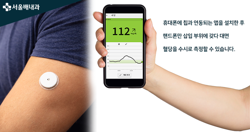 연속혈당측정기