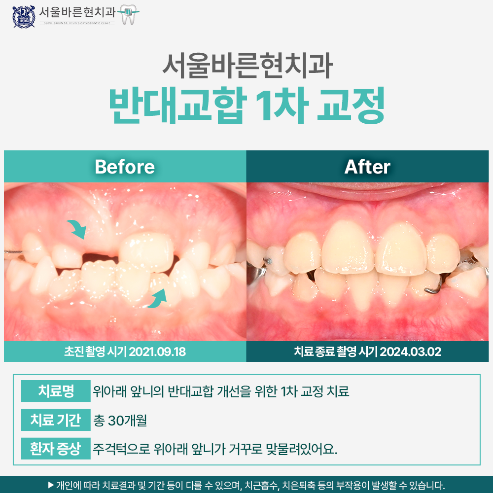 부산교정치과