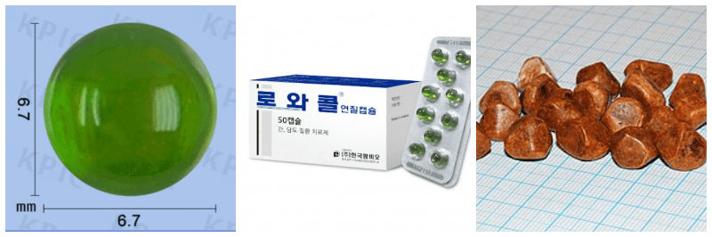 로와콜 연질캡슐, 담석 사진