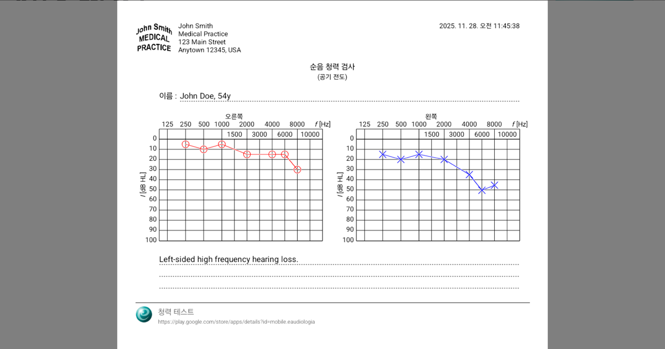 청력 검사 앱, 청력 테스트