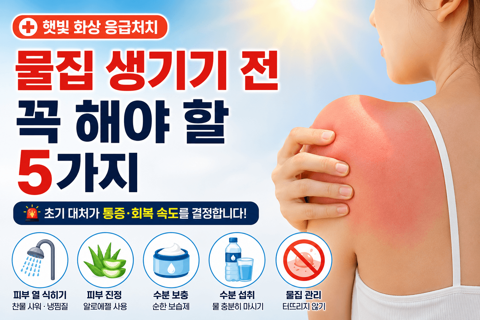 햇빛 화상 응급처치, 물집 생기기 전 꼭 해야 할 5가지