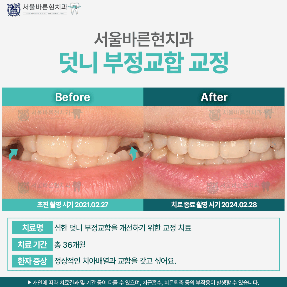 해운대교정치과