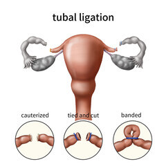 임신 초기 증상일까? 생리 불순일까?