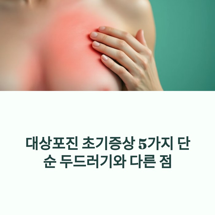대상포진 초기증상 5가지, 단순 두드러기와 다른 점 요약 이미지