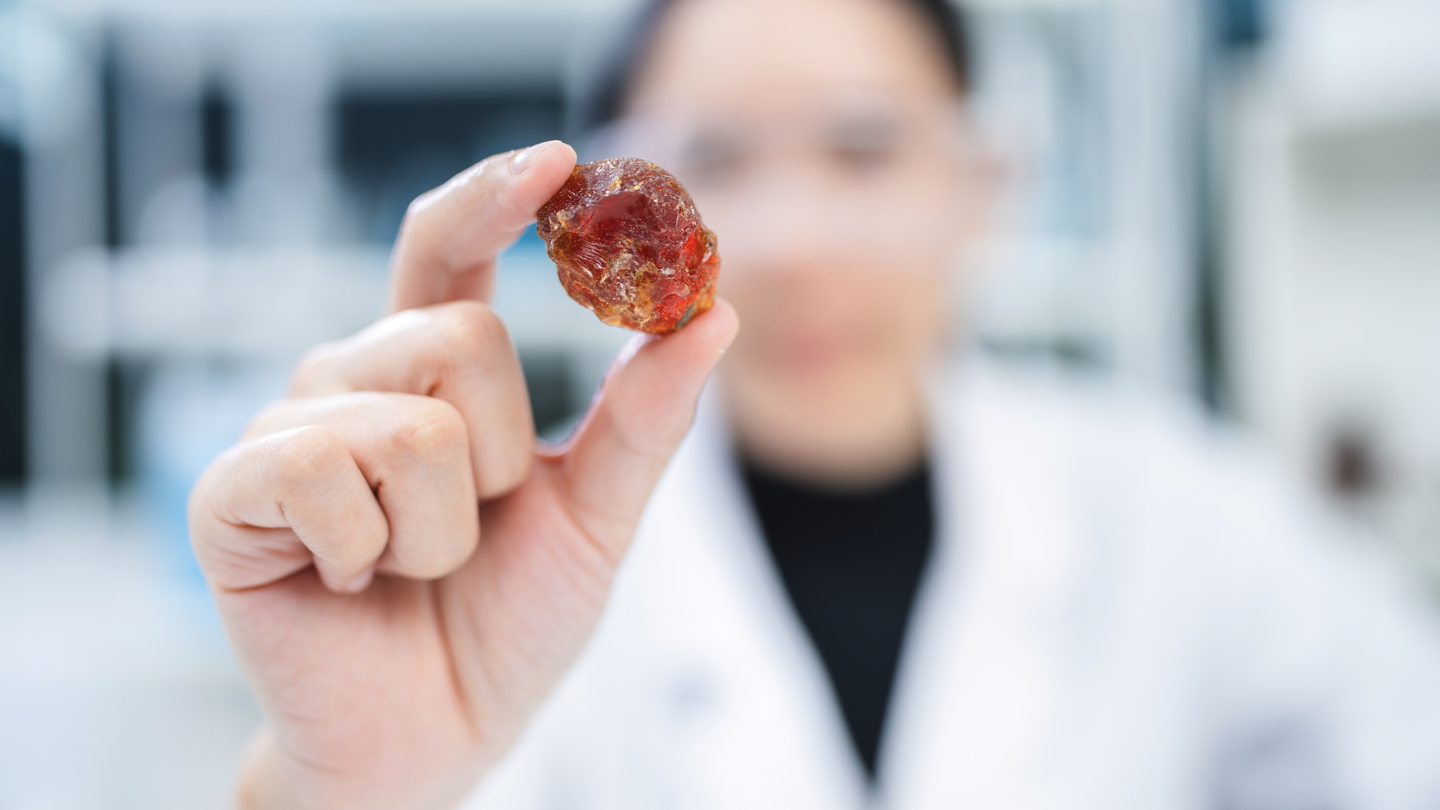 신장 결석 (Kidney Stones)