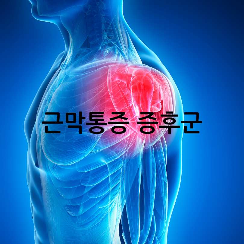 어깨 통증 원인