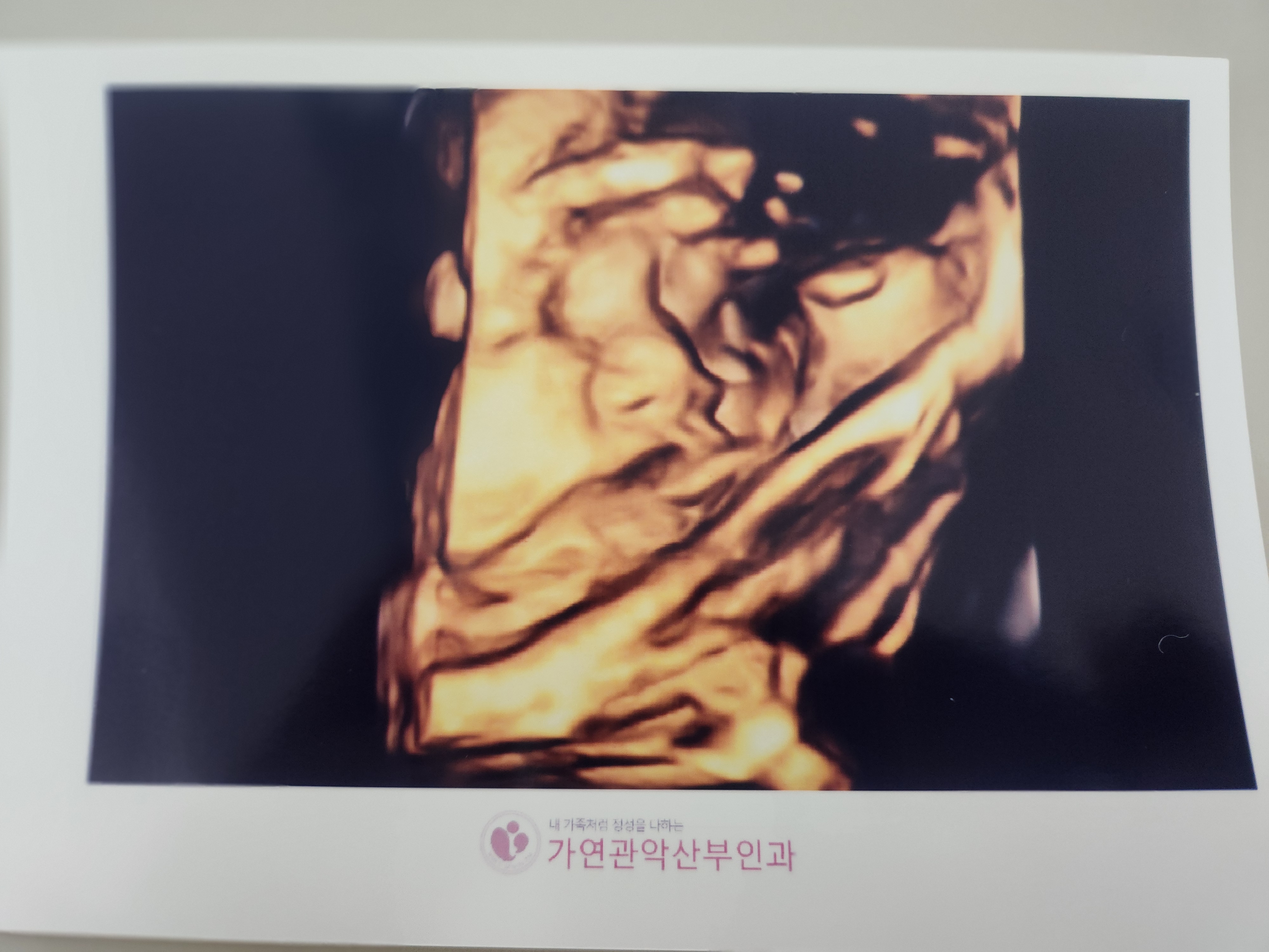 임신 33주 초음파
