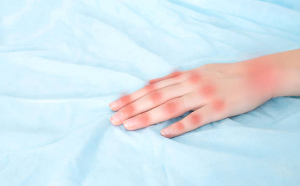 Pain with the Slightest Touch? Understanding Pseudogout and How It Differs from Gout.