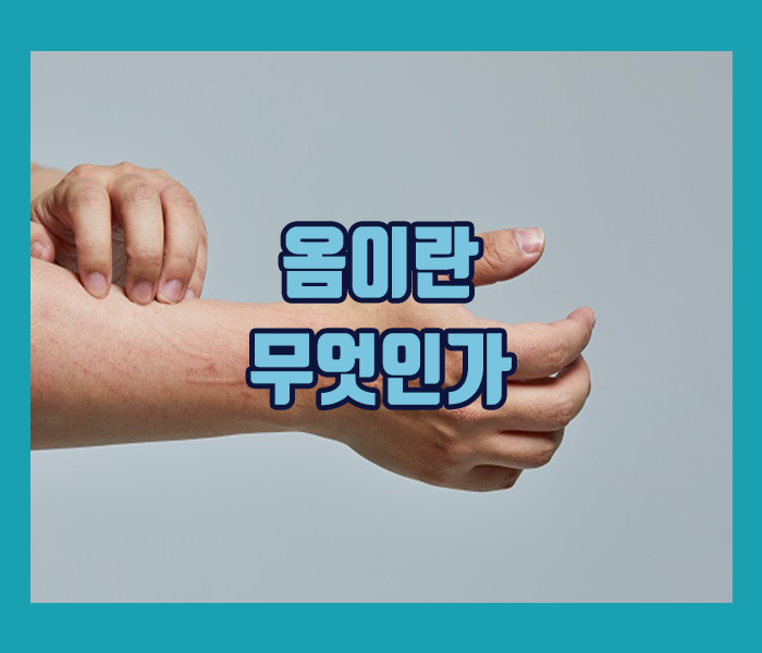 옴은 옴 진드기라는 작은 기생충에 의해 발생하는 전염성 피부감염입니다