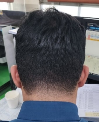 헤어라인정리달인