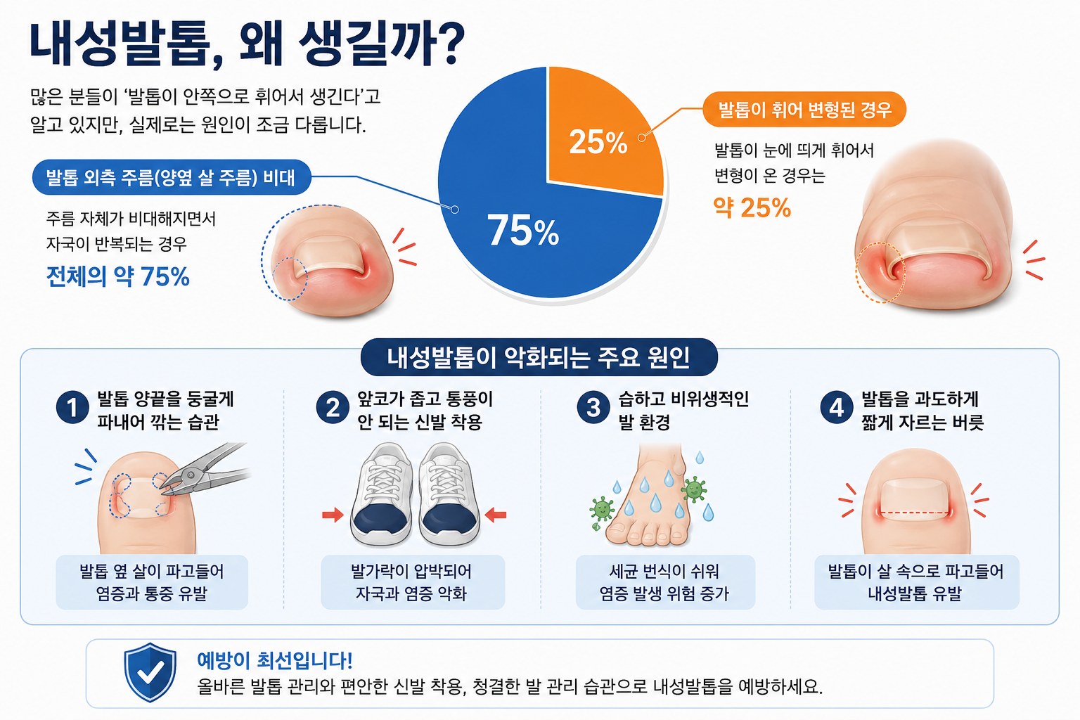 내성발톱 생기는 주요 원인들