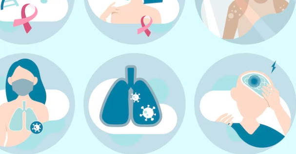 암을 예방하는데 도움이 되는 10가지 방법