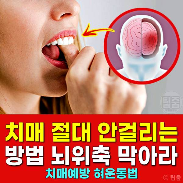 치매 안걸리는 방법 뇌위축 치매예방 혀운동 효과