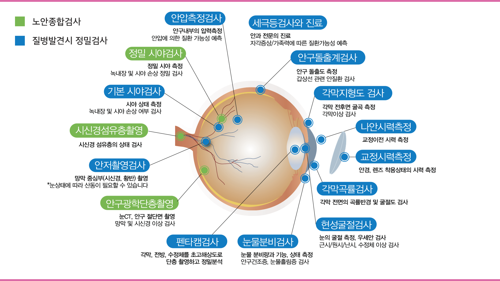 노안 검사