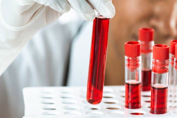 Ferritin 수치