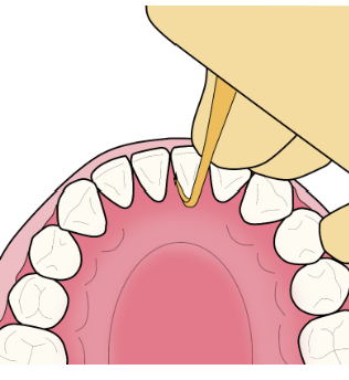 잇몸이 자주 붓는 이유