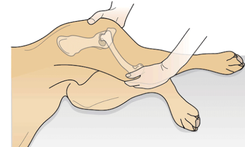 고관절 이형성증