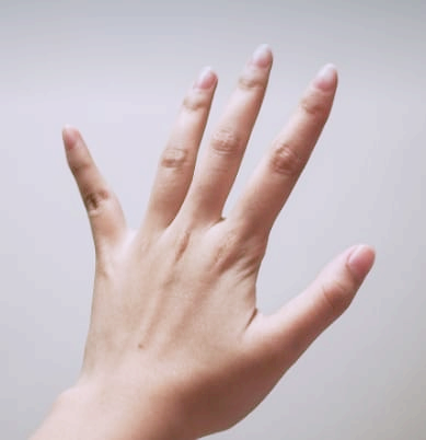 손가락 관절염 증상과 치료법