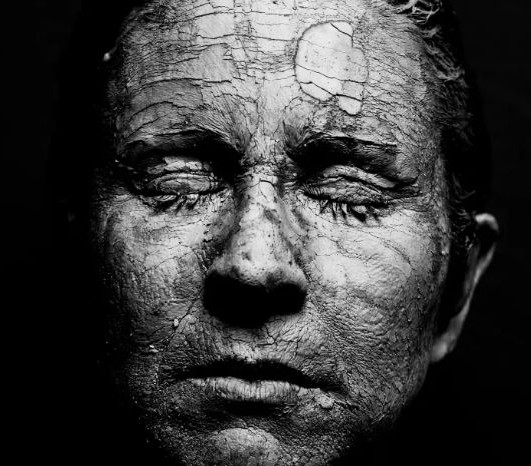 비판텐 연고 효능