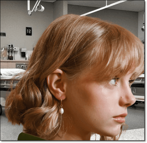 피어승으로 귀볼 몽우리가 생긴 여성