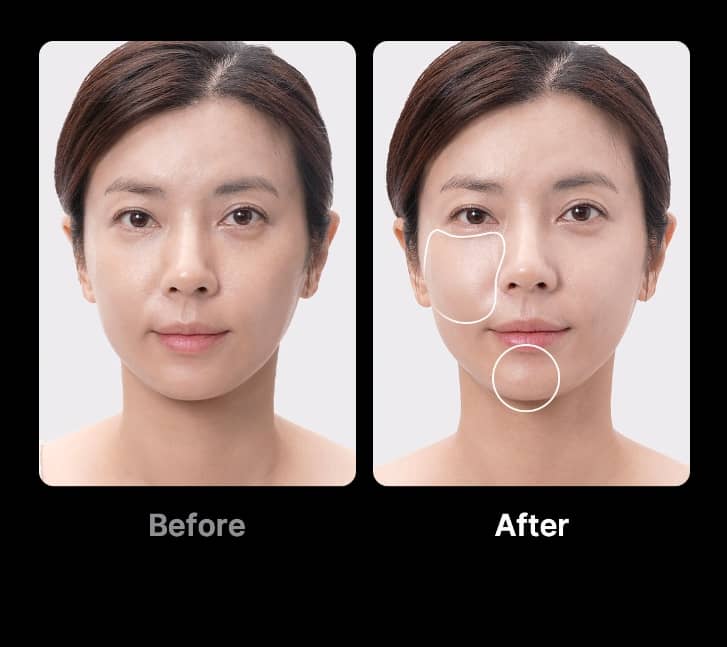 메디큐브 부스터프로 이미지