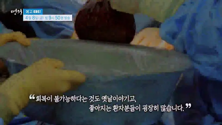 명의 간이식 간암 알프스수술 간경변 간암 간경화 간염 바이러스 전문의 서경석 김기훈 임영석 교수 진료 예약 소개