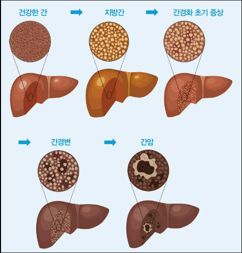 간(2)