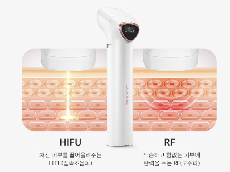 루킨스 초음파 사진