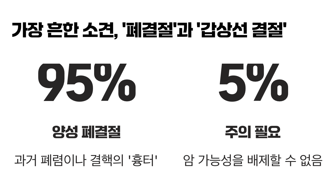 가장 흔한 소견, '폐결절'과 '갑상선 결절'