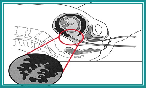태아 성별알수있는시기