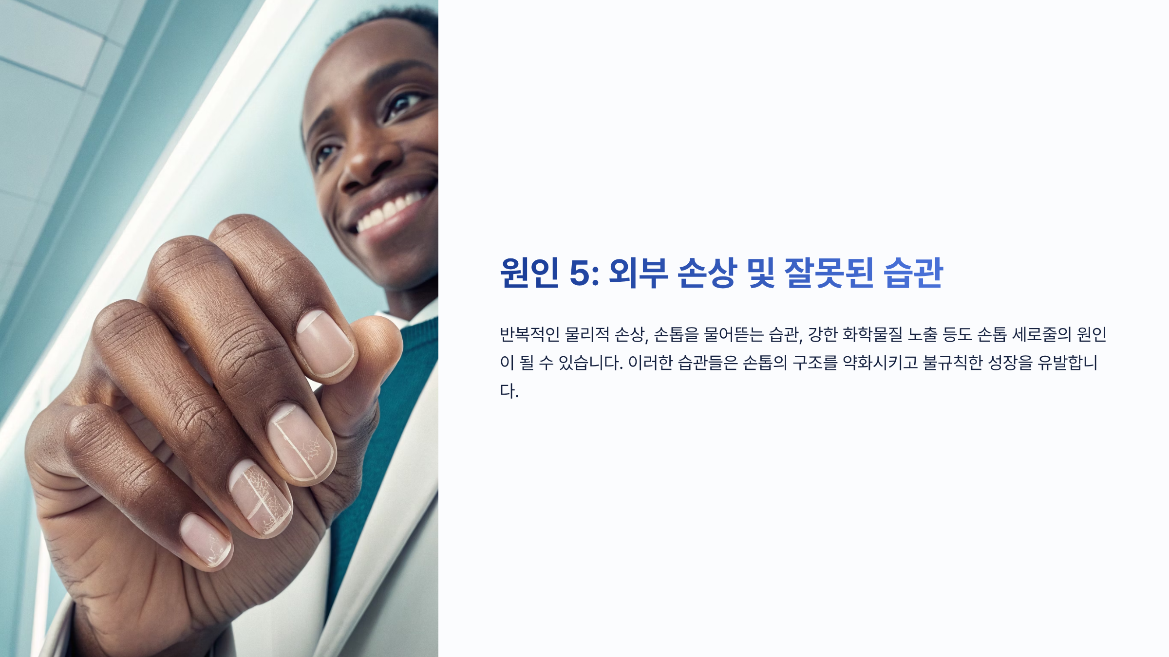 손톱 세로줄 울퉁불퉁 ❘ 단순 미용 문제가 아닌 신체 건강 신호 완벽해석