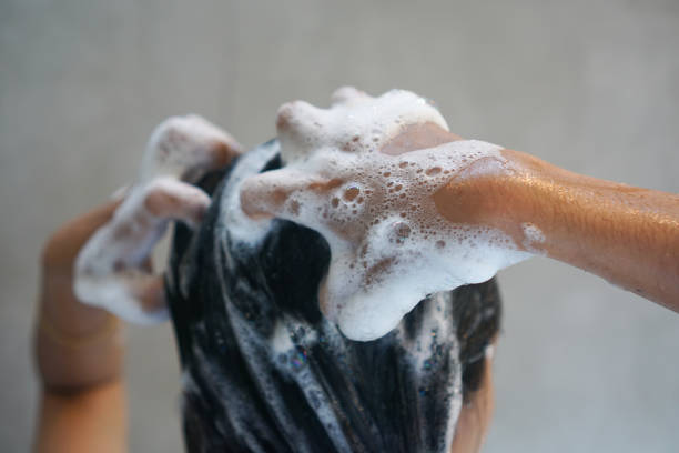 비듬 예방과 관리 방법