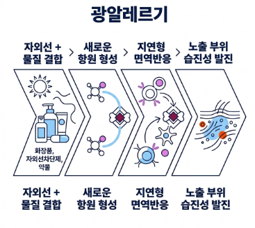 햇빛 알레르기 증상