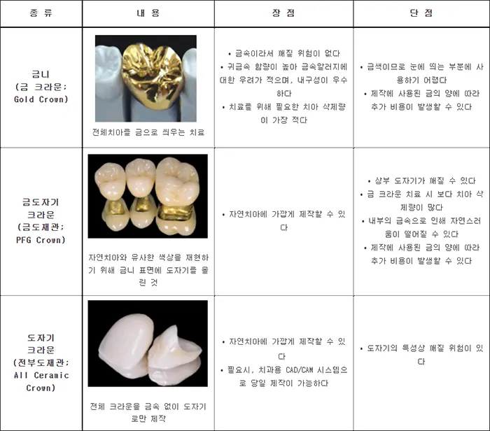 크라운 종류