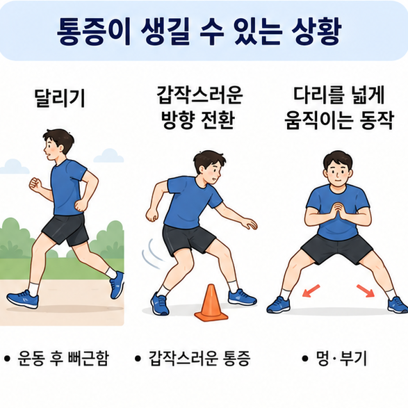 달리기와 방향 전환 등 내전근에 부담을 줄 수 있는 동작과 운동 후 통증, 멍, 부기를 보여주는 이미지