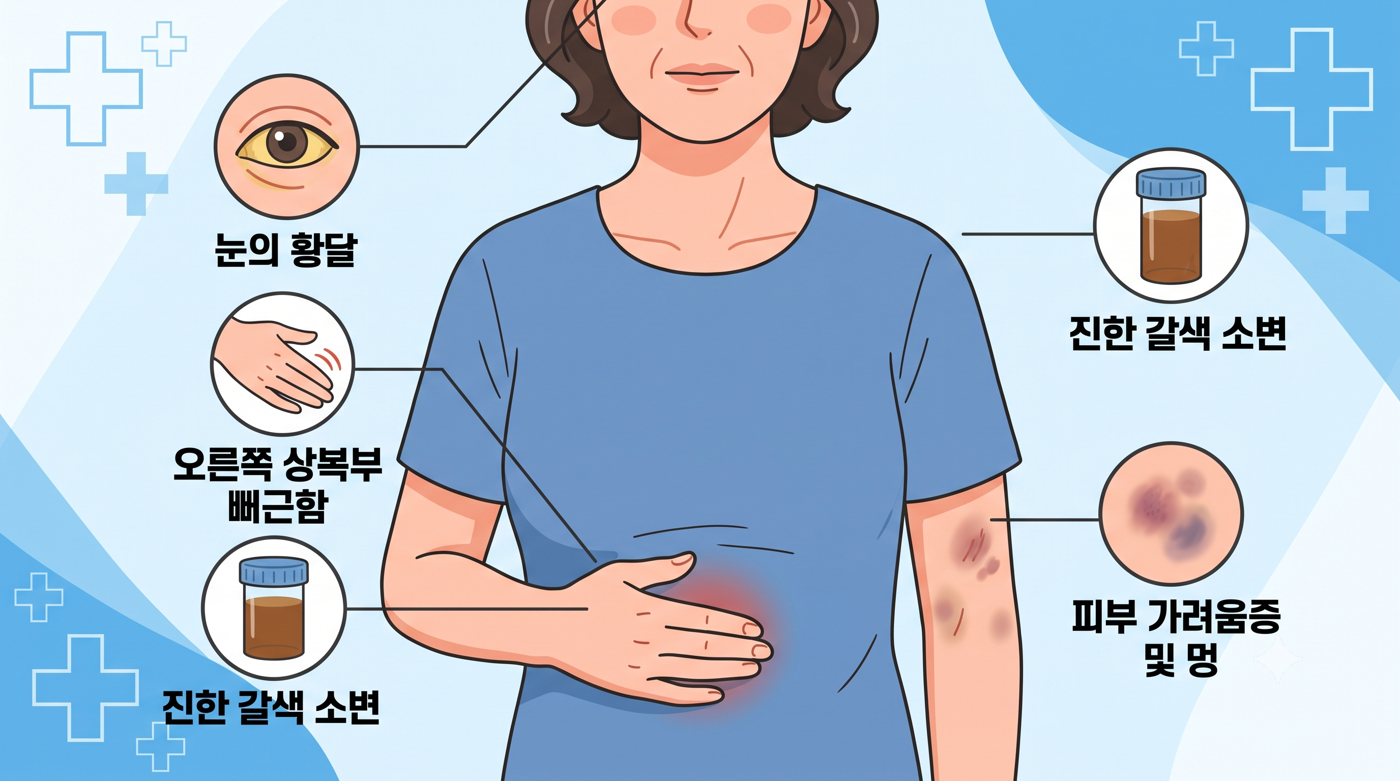 50대 여성을 중심으로 간 기능 저하 시 나타나는 주요 증상을 시각화한 인포그래픽