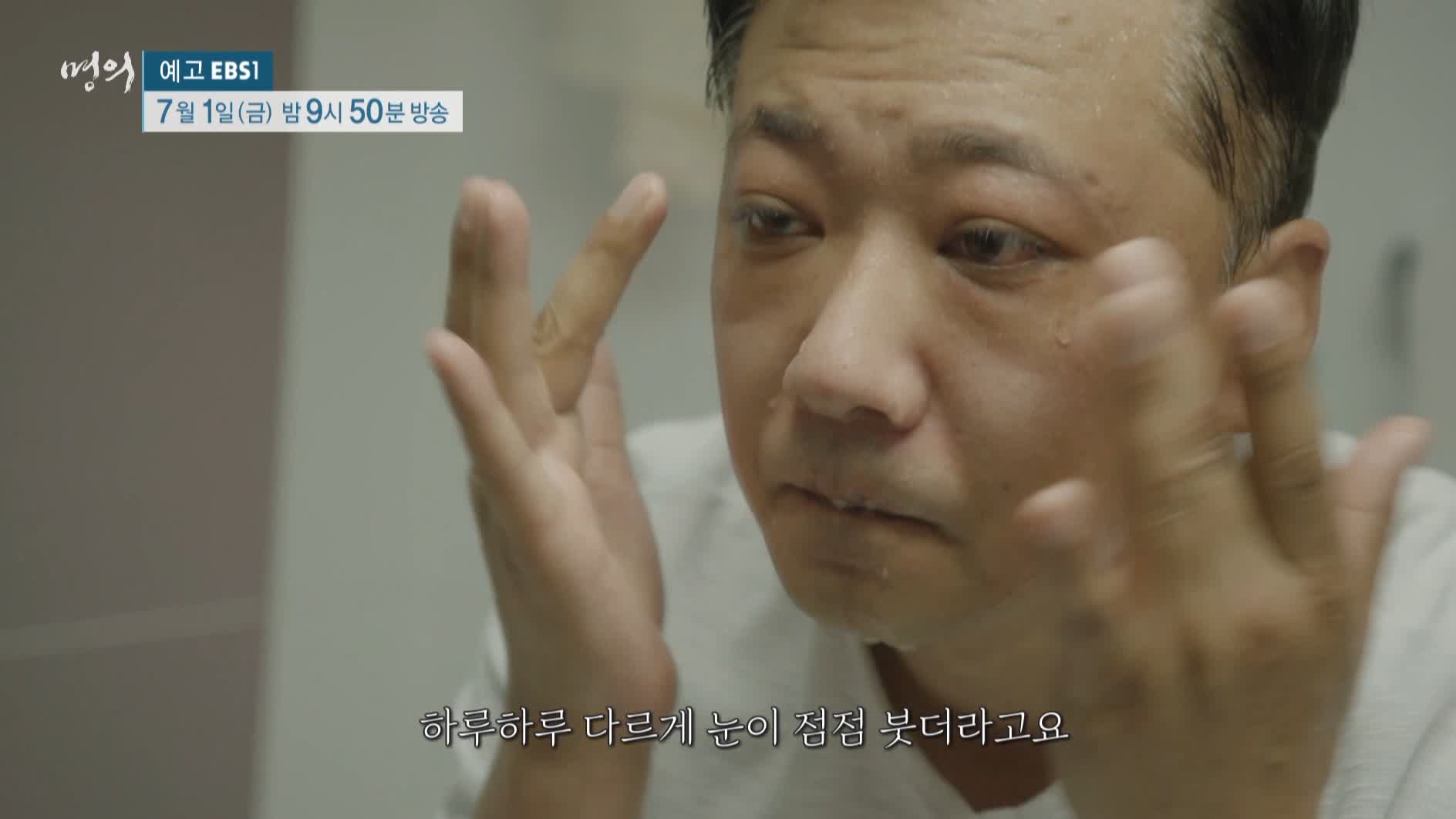 명의 갑상선호르몬 성장호르몬 쿠싱증후군 나잇살 고도비만 골다공증 호르몬 극복 치료법 내분비 내과 안철우 교수