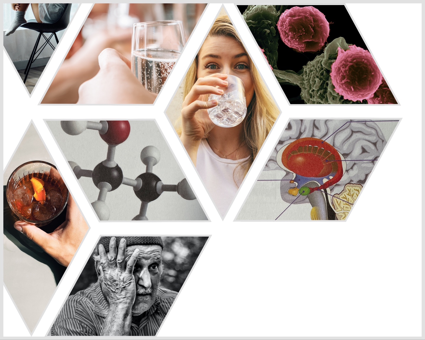 과한 음주는 알콜성 치매를 유발한다