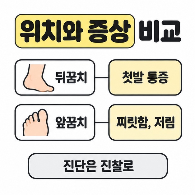 뒤꿈치의 첫발 통증과 앞꿈치의 찌릿함 및 저림을 비교하고 진단은 진찰로 확인하도록 안내한 그림