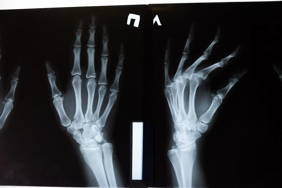 손가락과 손목의 x-ray 사진
