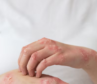 겨드랑이 통증 32