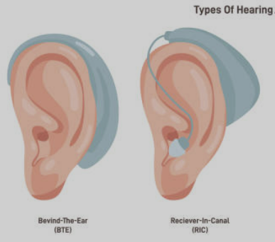 보청기 최저가 비교 사이트ㅣ보청기 저렴하게 구입하기ㅣ고르는방법