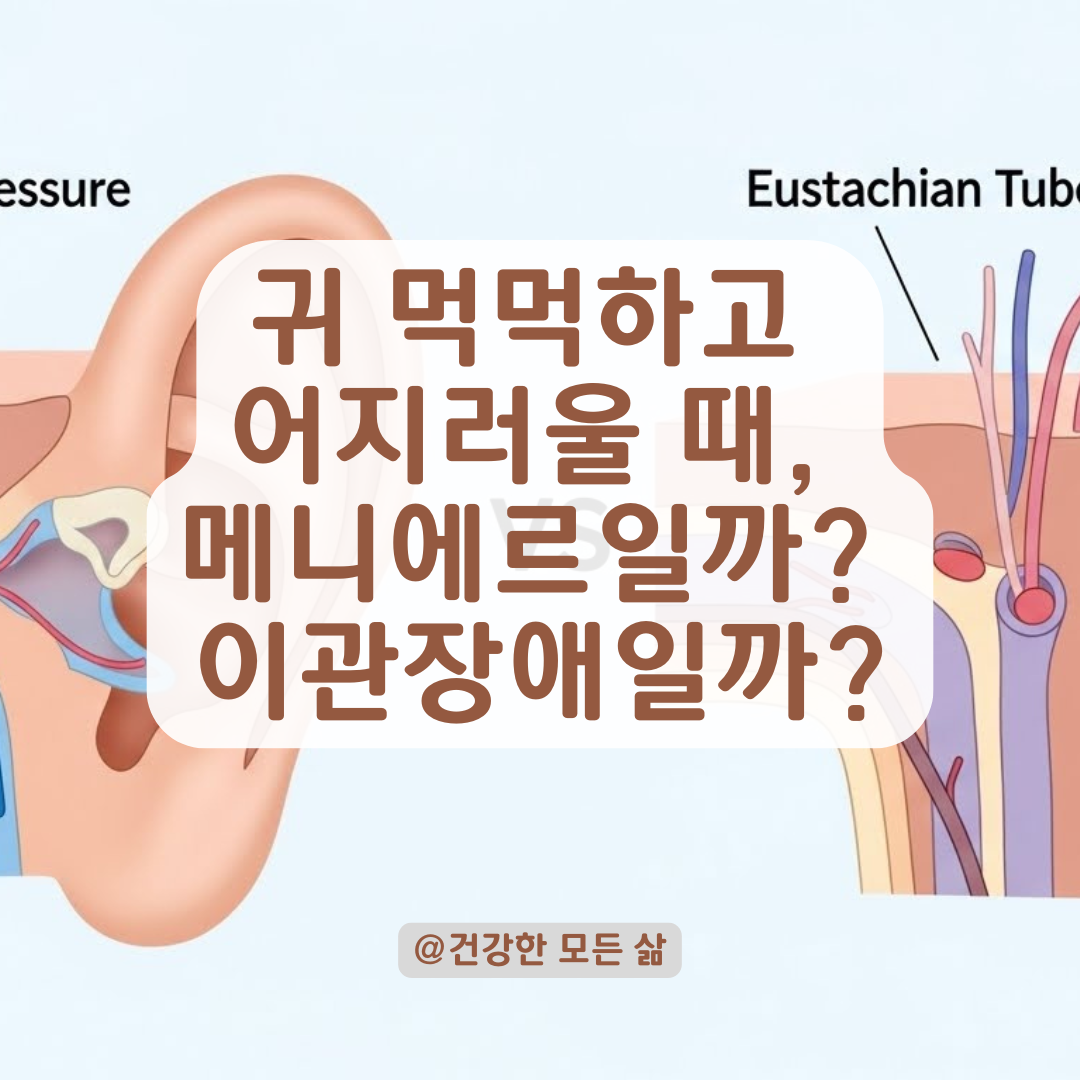 양쪽 귀가 꽉 막히고 어지럽다면? 메니에르 vs 이관 기능 장애 완벽 구분법.