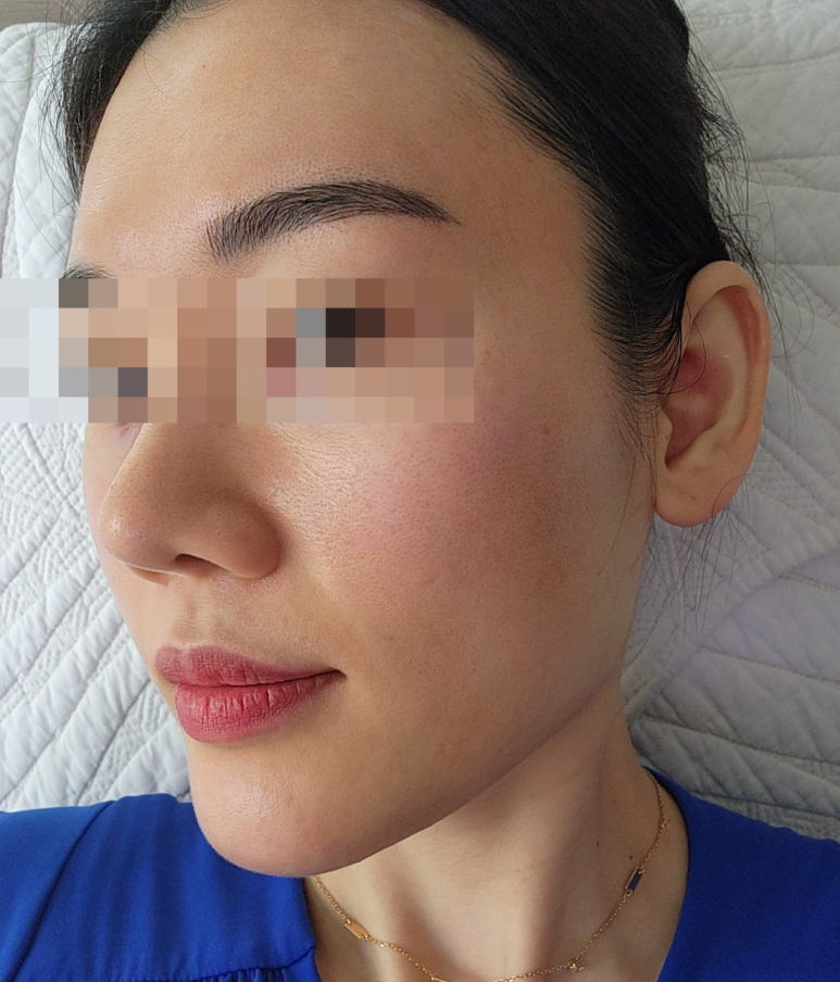 아이올리지오 후기