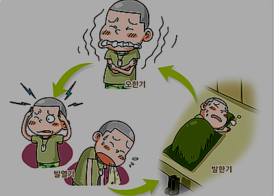 말라리아 증상
