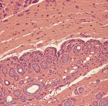 퇴행성관절염 증상 총정리2