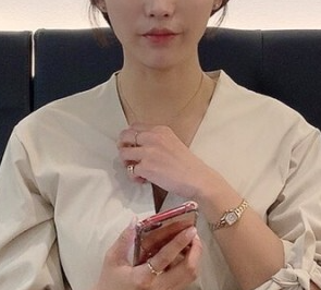 인중 축소 수술 후기