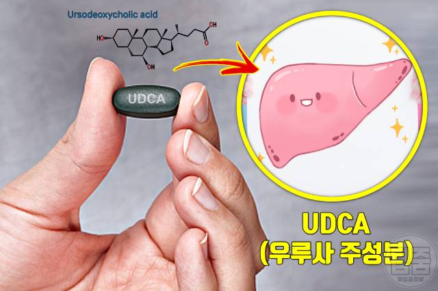 우루사 효능 간영양제 udca 효과