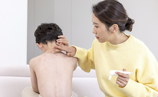 지연성 알러지 검사 증상&amp;#44; 원인&amp;#44; 검사 비용 총정리